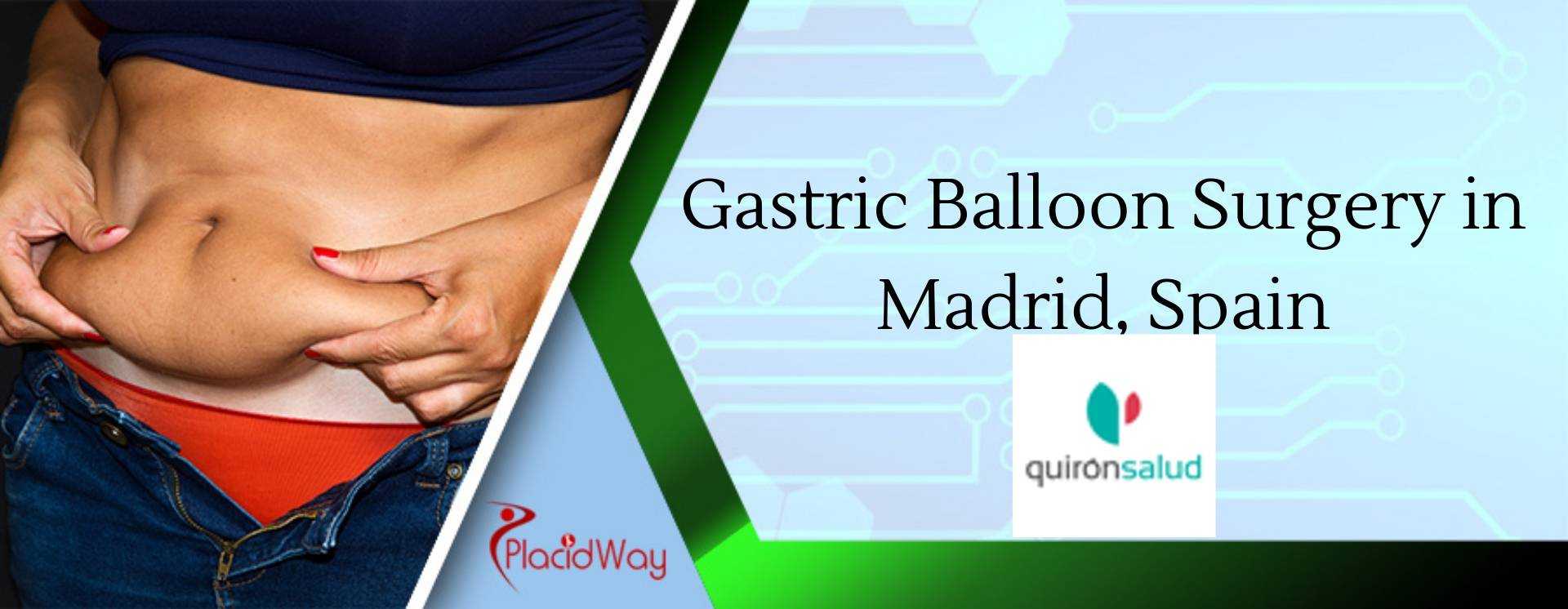 Gastric Balloon Surgery in Madrid, Spain